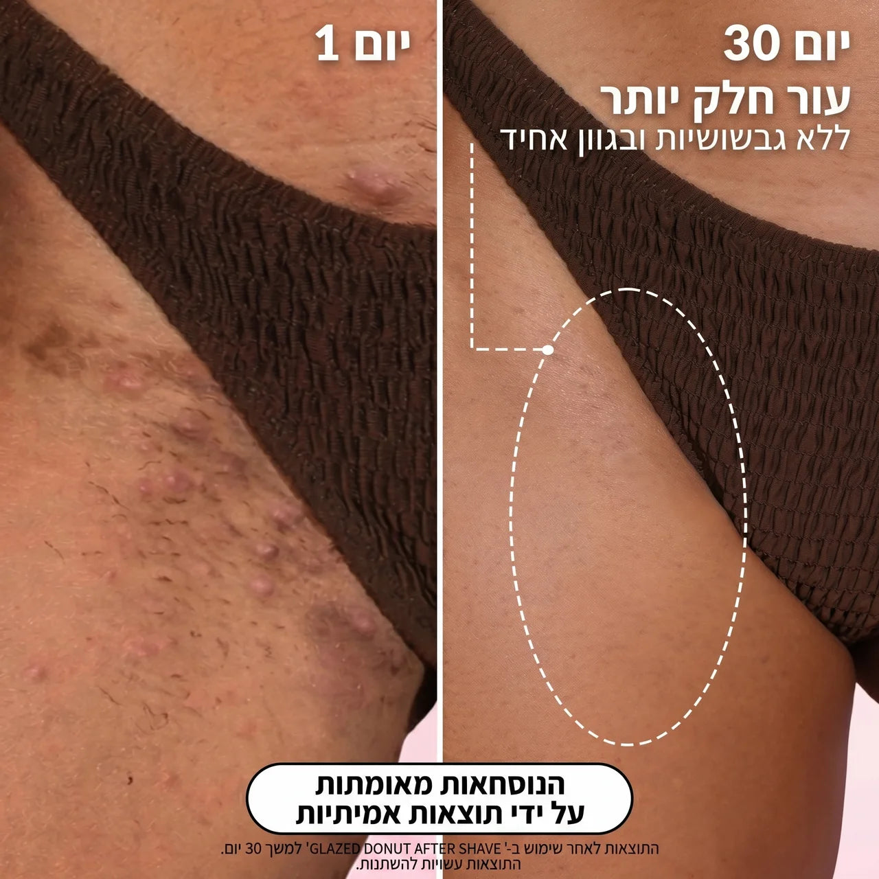 סרום סקין+ לאחר גילוח