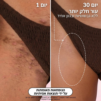 סרום סקין+ לאחר גילוח